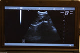 Hospital Laptop Machine Ultrasound Scanner Convex/Linear/Endovaginal Probe +Case 190891044686