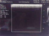 Philips (ATL) L12-5 (50mm) Linear Array Ultrasound Transducer Probe