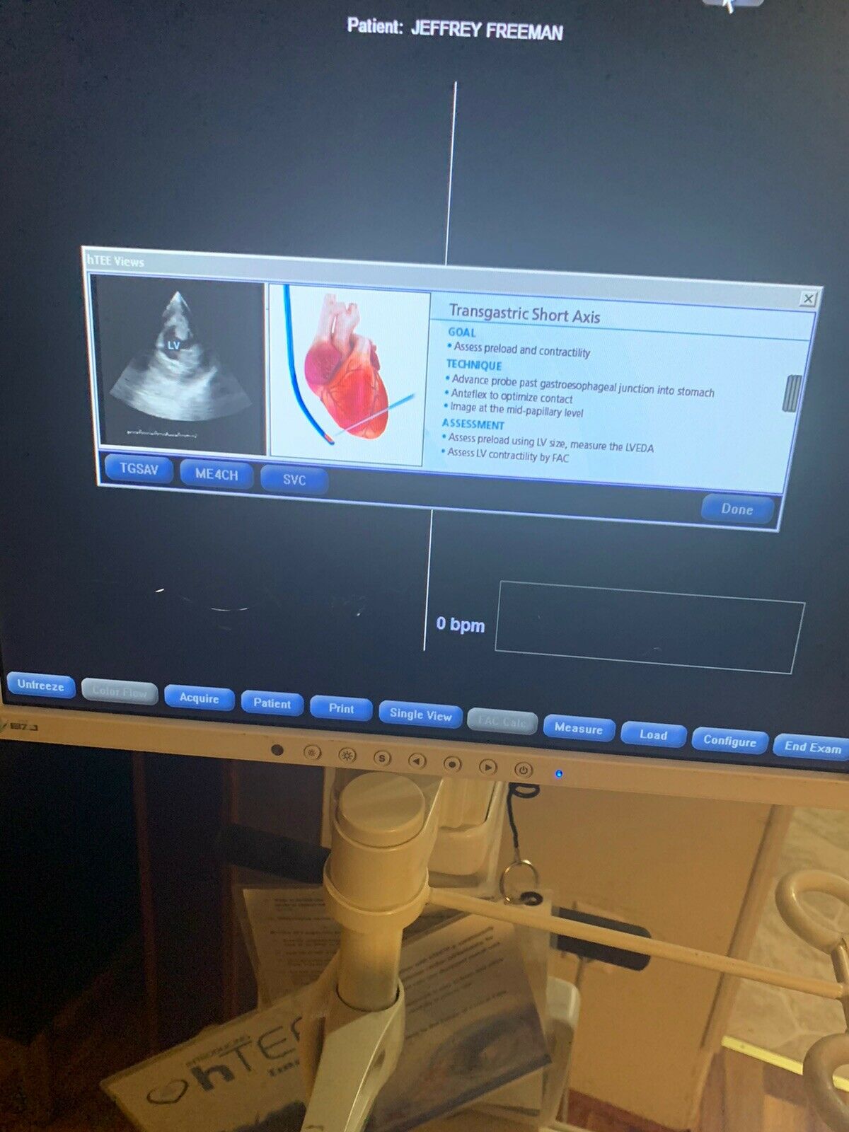 ImaCor Hemodynamic Ultrasound Machine Zura-1000 System DIAGNOSTIC ULTRASOUND MACHINES FOR SALE