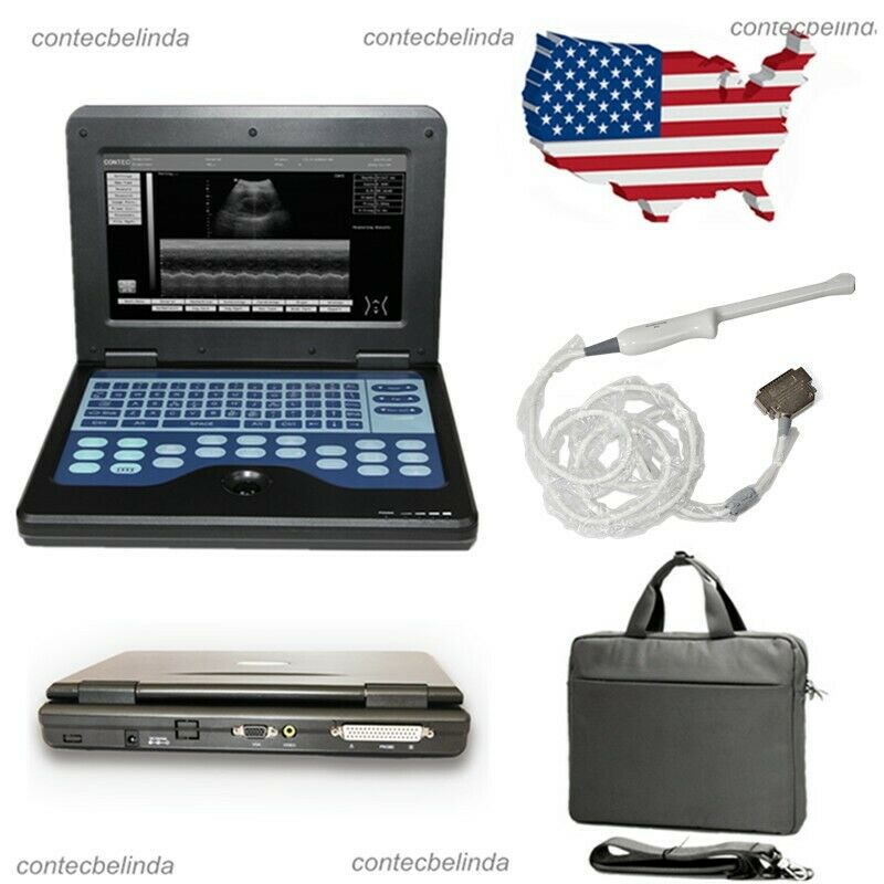 Portable Laptop Ultrasound Machine Digital Human Scanner 6.5M Tranvaginal Probe DIAGNOSTIC ULTRASOUND MACHINES FOR SALE