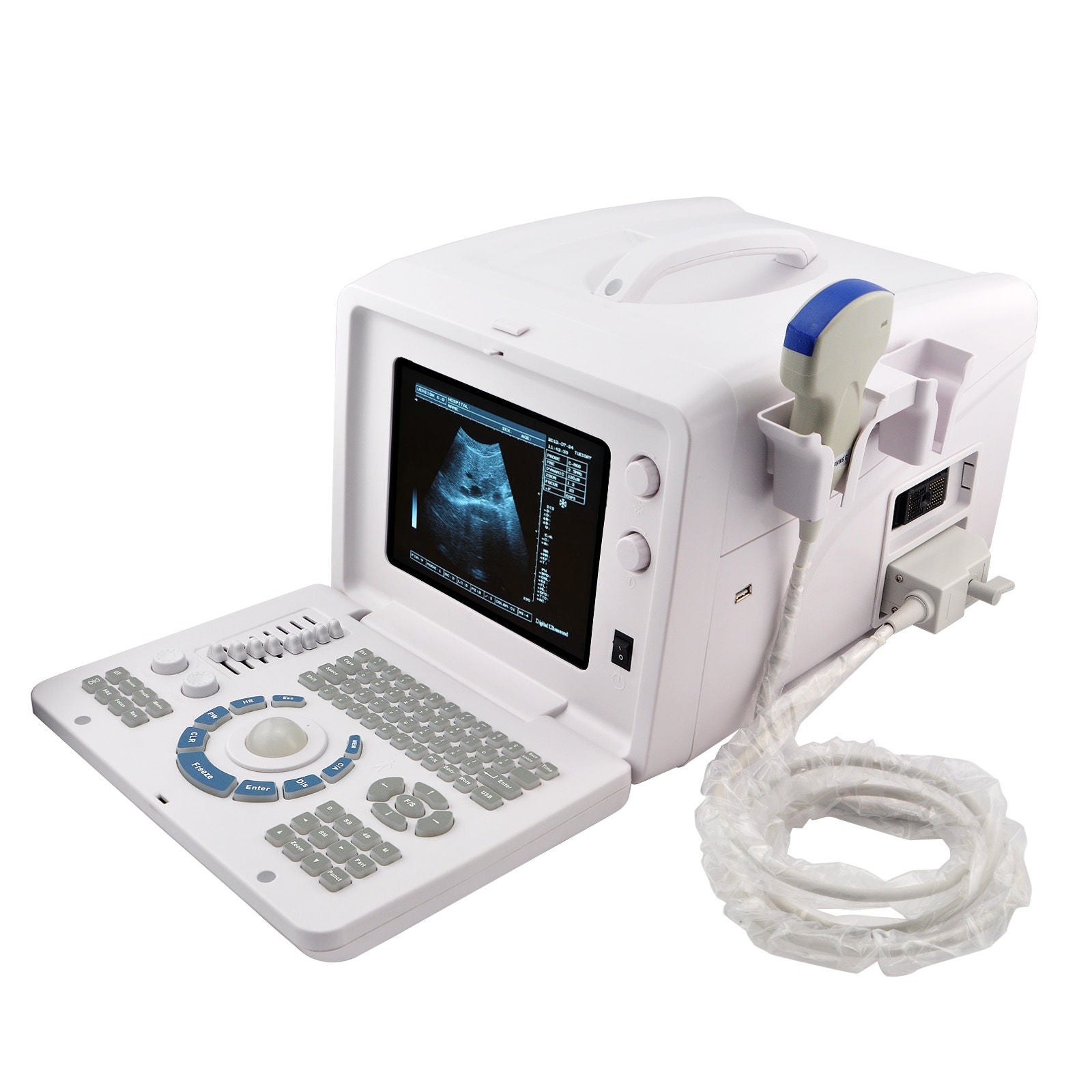 NEW 10 inch SVGA Portable Full Digital Ultrasound Scanner 3.5MHZ CONVEX probe DIAGNOSTIC ULTRASOUND MACHINES FOR SALE