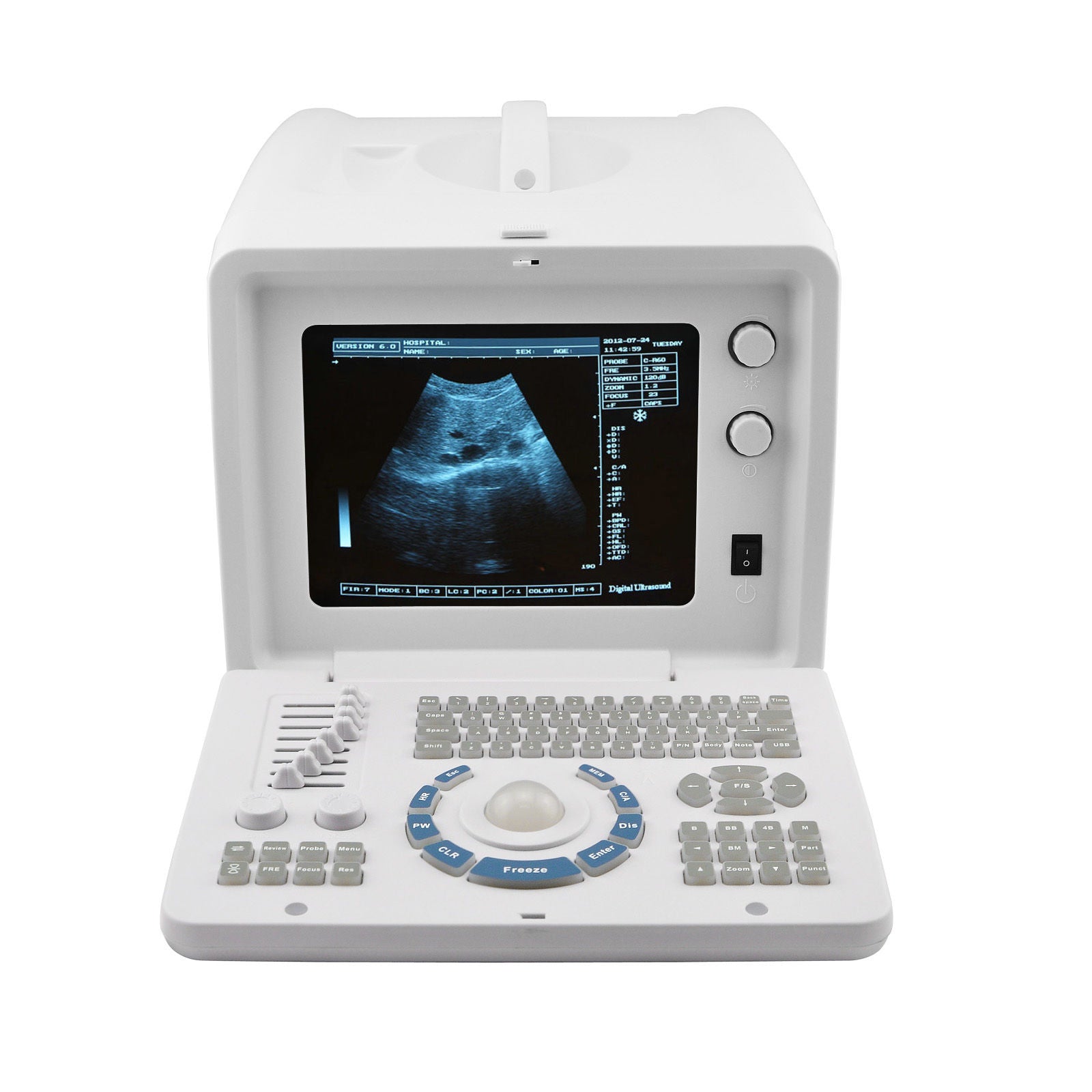 NEW 10 inch SVGA Portable Full Digital Ultrasound Scanner 3.5MHZ CONVEX probe DIAGNOSTIC ULTRASOUND MACHINES FOR SALE