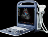Used SonoScape S2 with Linear Array Probe L741 Excellent Condition,MSK,Vascular
