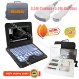 Portable Laptop Machine Digital Ultrasound Scanner, probe, human/vet, USA Fedex