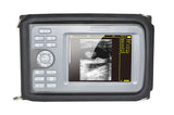CE Handheld Smartscan Ultrasound Scanner Systerm,Convex Probe + ECG /EKG Machine