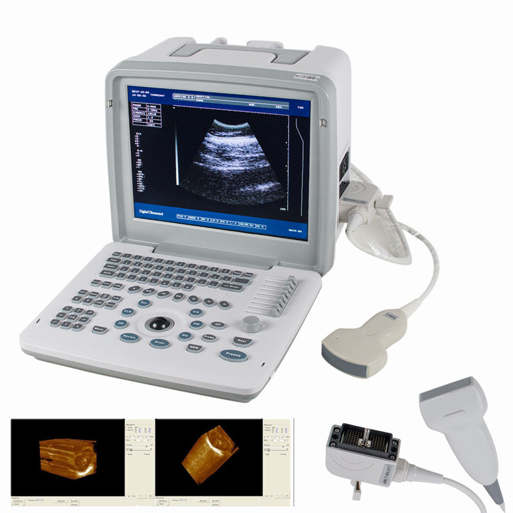 Hot S+Digital SVGA 3D Portable Ultrasound Scanner Machine Convex  Linear 2 Probe 190891580481 DIAGNOSTIC ULTRASOUND MACHINES FOR SALE