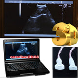 Full Digital Laptop Ultrasound Scanner 2 Probes Covex + Linear Probes 3D Precise 190891802569