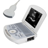 Portable Full Digital Laptop 10.4" Medical Ultrasound Scanner 3.5 Convex probe