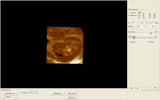 FAST 12'' Ultrasound Scanner Digital Machine+3D Image+Convex &Linear 2 Probes 190891919595
