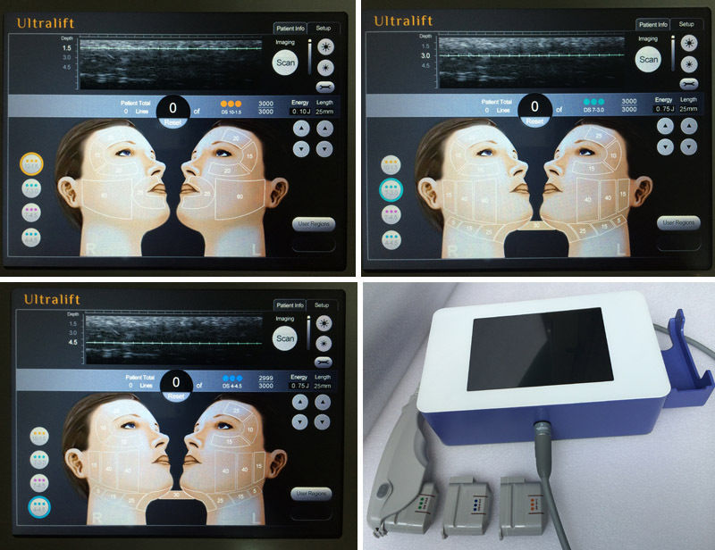 High Intensity Focused Ultrasound HIFU RF Wrinkle Removal Anti-Aging Machine 601393982494 DIAGNOSTIC ULTRASOUND MACHINES FOR SALE