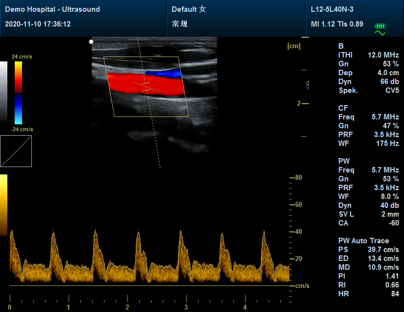 Portable High Resolution Color Doppler Ultrasound Scanner with Convex Probe New 6945040100362 DIAGNOSTIC ULTRASOUND MACHINES FOR SALE