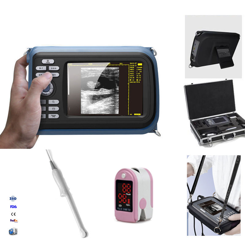 Handheld 5.5'' Digital LCD Monitor Ultrasound Scanner System,Transvaginal Probe, 190891996671 DIAGNOSTIC ULTRASOUND MACHINES FOR SALE