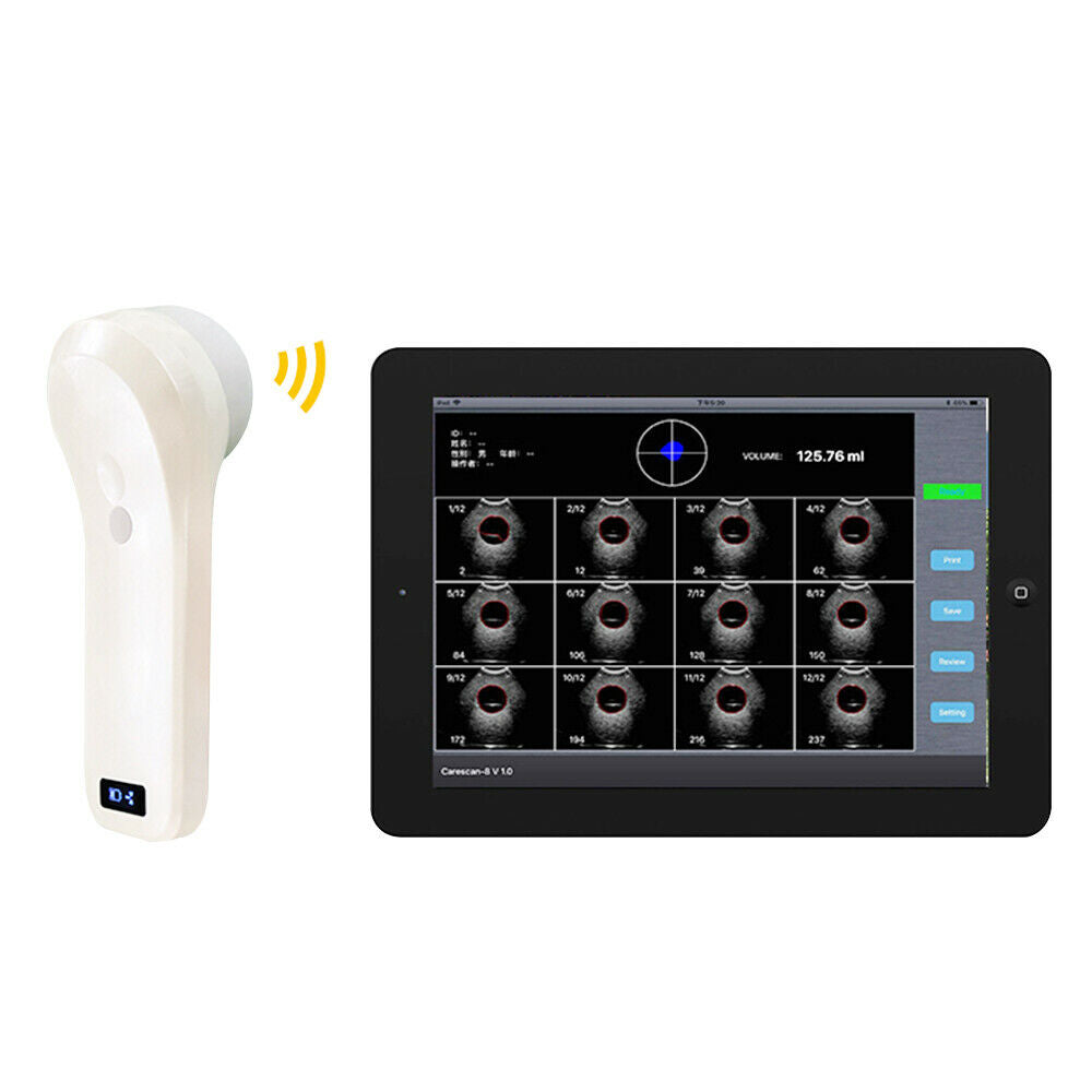 Portable Handheld 4D Scan/Array Probe Wireless Probe Bladder Ultrasound Scanner DIAGNOSTIC ULTRASOUND MACHINES FOR SALE