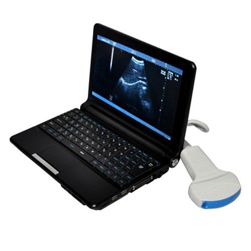 10.1'' Digital Laptop Ultrasound Scanner System W 5.0MHz Micro-convex Probe +bag DIAGNOSTIC ULTRASOUND MACHINES FOR SALE