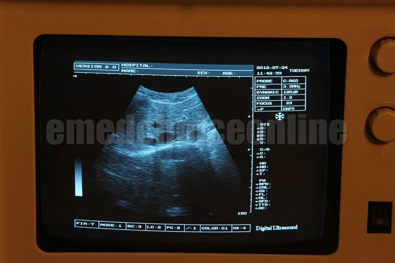 Hot Top selling 10-inch SVGA high monitor Ultrasound Scanner +3D+ LINEAR probe DIAGNOSTIC ULTRASOUND MACHINES FOR SALE