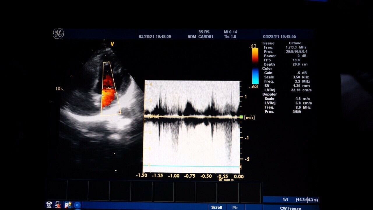 GE Logiq E Ultrasound System Version 5.. With CW option. Sector 3srs DIAGNOSTIC ULTRASOUND MACHINES FOR SALE