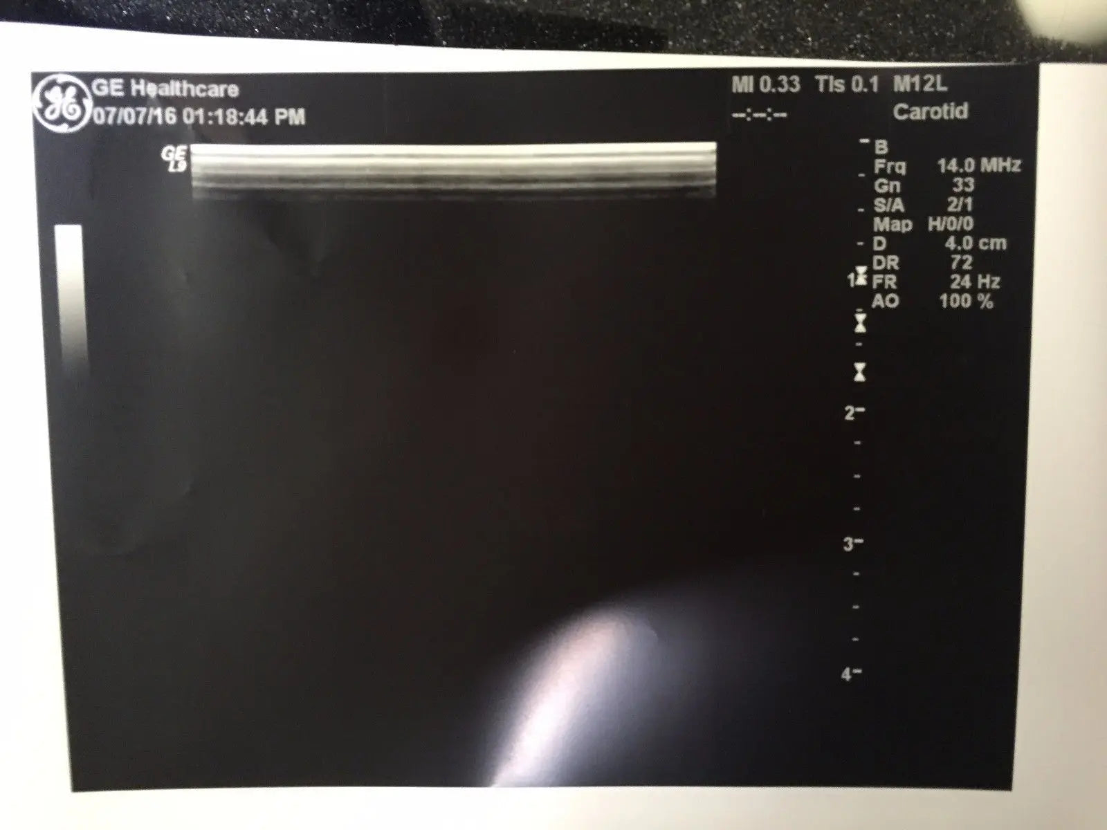 GE M12L Ultrasound Transducer  for GE Logiq Systems DIAGNOSTIC ULTRASOUND MACHINES FOR SALE