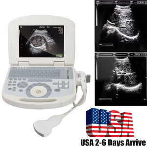 US Portable Digital Laptop Medical Ultrasound Scanner Machine Convex Probe 3D CE 190891422491