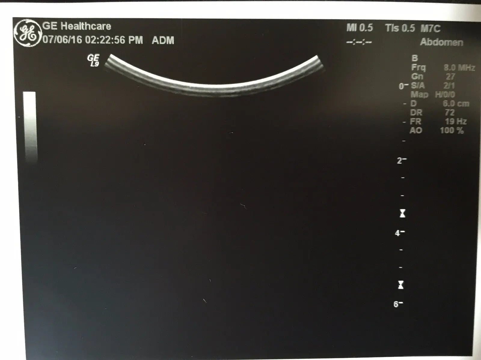 GE M7C Convex Ultrasound Transducer  for GE Logiq Systems DIAGNOSTIC ULTRASOUND MACHINES FOR SALE