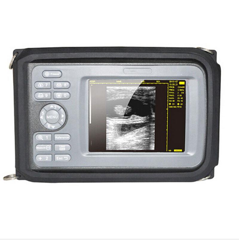 5.5 " Handheld Ultrasound Scanner/Machine  Digital +Linear Probe For Human CE DIAGNOSTIC ULTRASOUND MACHINES FOR SALE