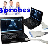Free 3D Laptop Ultrasound Machine Scanner+ Convex +Linear+ Transvaginal 3 Probes