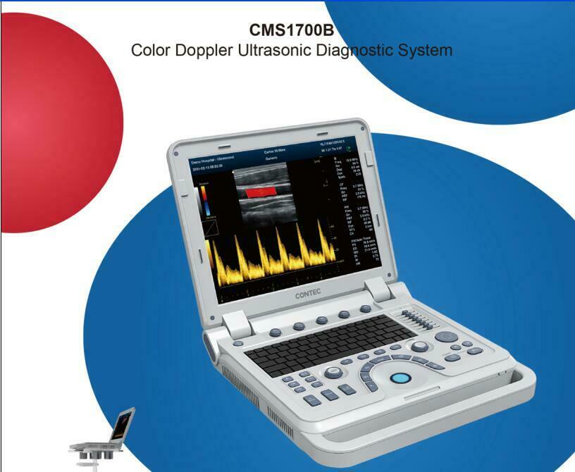 Portable Cardiac Ultrasound Scanner Diagnostic Color Doppler Phased Array Probe 6945040100362 DIAGNOSTIC ULTRASOUND MACHINES FOR SALE