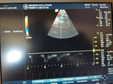 GE 8C-RS Probe / Transducer Micro-Convex