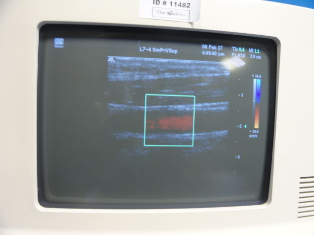 ATL L7-4 38mm Linear Array Transducer Probe for ATL HDI Series Systems (12605) DIAGNOSTIC ULTRASOUND MACHINES FOR SALE