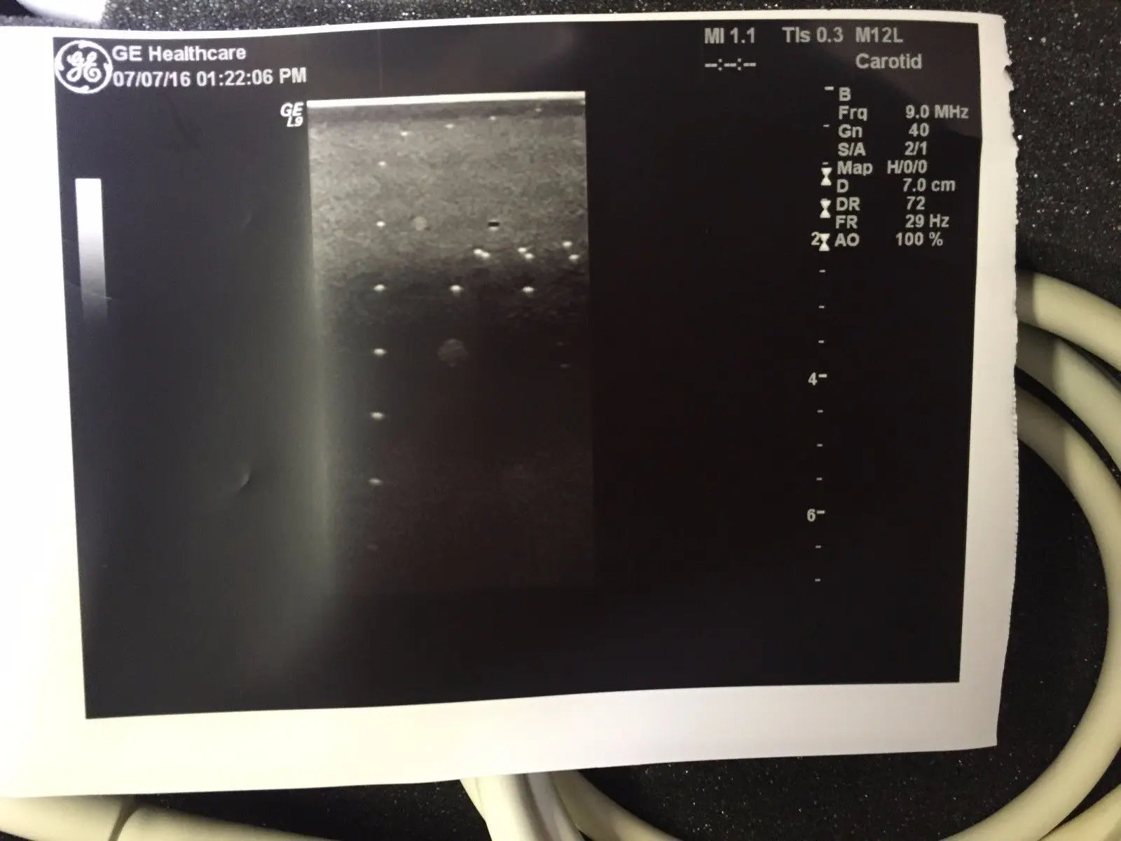GE M12L Ultrasound Transducer  for GE Logiq Systems DIAGNOSTIC ULTRASOUND MACHINES FOR SALE