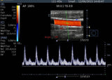 Veterinary Color Doppler Touch Screen Ultrasound 15"  with Linear Array Probe