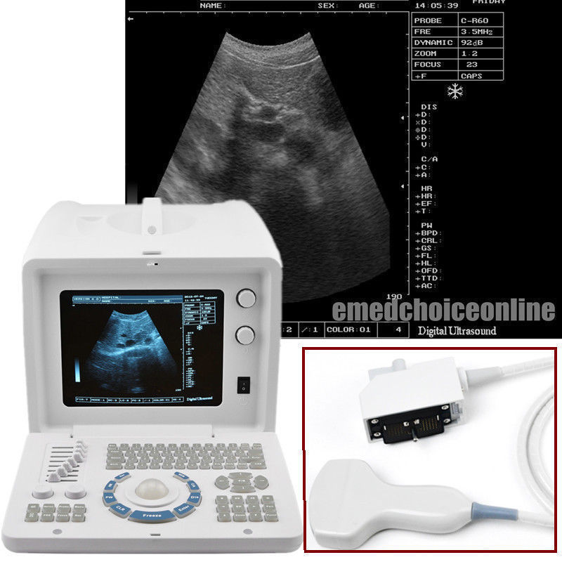 NEW 10 inch SVGA Portable Full Digital Ultrasound Scanner 3.5MHZ CONVEX probe DIAGNOSTIC ULTRASOUND MACHINES FOR SALE