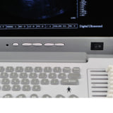 Full Digital Portable LED Ultrasound Scanner abdominal Convex + Linear Probe Set