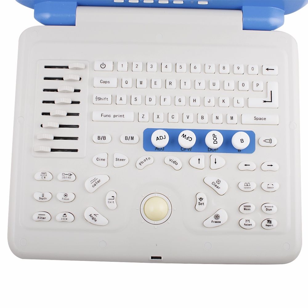 Laptop Color Doppler Ultrasonic Ultrasound Scanner Convex Linear 2 Probes  A+ DIAGNOSTIC ULTRASOUND MACHINES FOR SALE