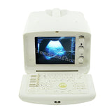 Full Digital Portable Ultrasound Scanner machine +Convex + Vignial  2 Probes+3D