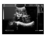 Portable Laptop Ultrasound Machine Scanner Convex Probe 3D Software Image 190891045898