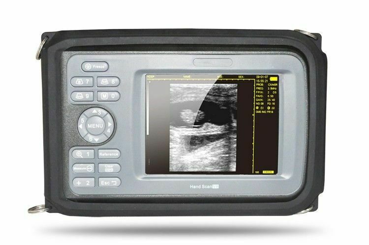 Medical Handheld Ultrasound Scanner Machine With Convex Transducer For Human USA DIAGNOSTIC ULTRASOUND MACHINES FOR SALE