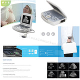 USA! Clear Digital Laptop Medical Ultrasound Scanner Machine Convex Probe 3D 190891422491