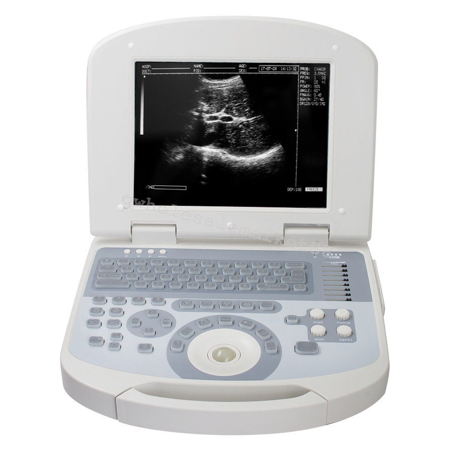 Laptop Ultrasound Machine Scanner Convex Probe 3D Software High Resolution Clear 190891045898 DIAGNOSTIC ULTRASOUND MACHINES FOR SALE