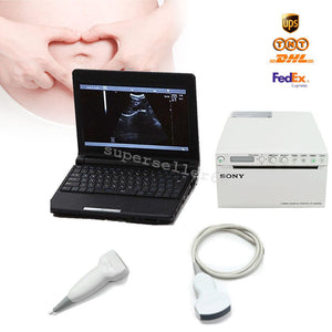 Digital LCD Monitor Ultrasound Scanner+Convex Linear Probe+Sony UP-897MD Printer