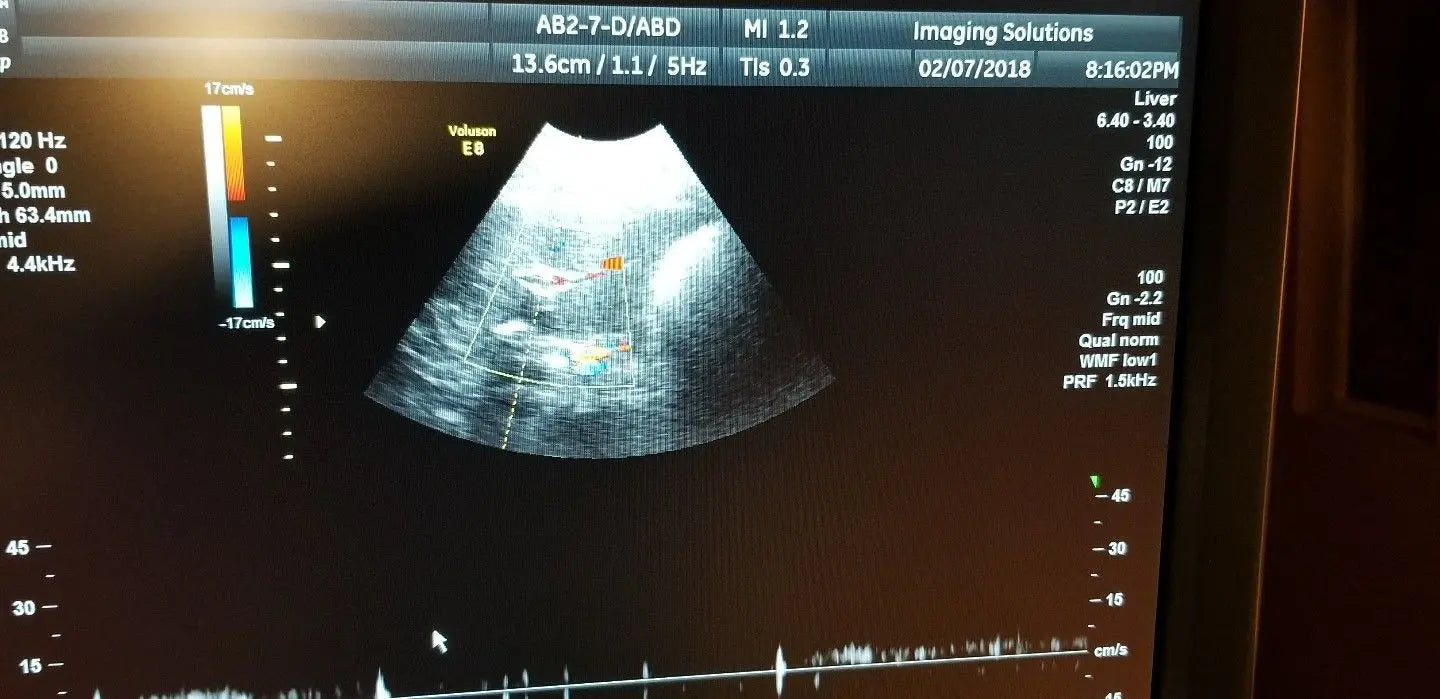 GE AB2-7-D Ultrasound Probe / Transducer DIAGNOSTIC ULTRASOUND MACHINES FOR SALE