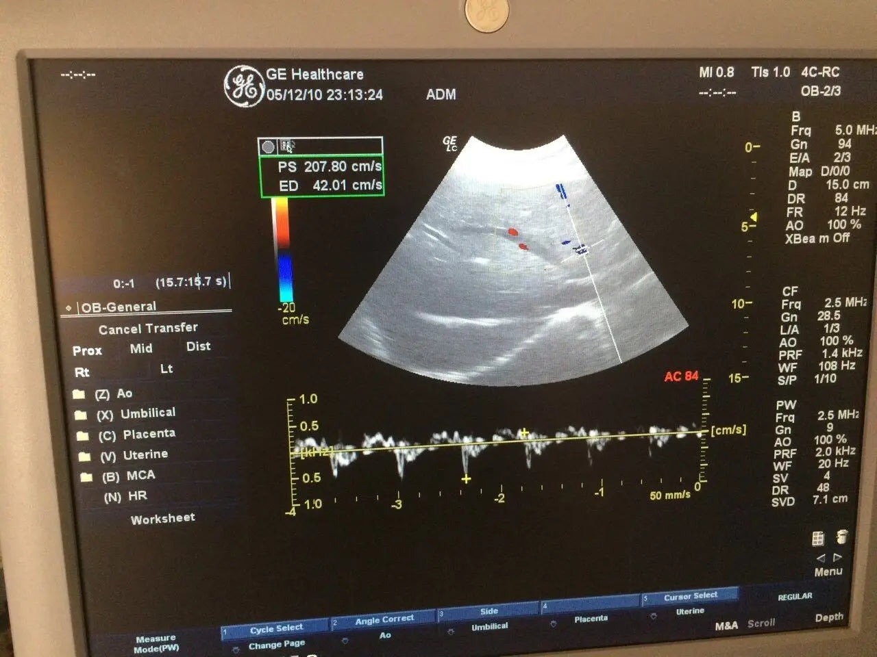 GE Ultrasound transducer probe convex 4CRC DIAGNOSTIC ULTRASOUND MACHINES FOR SALE