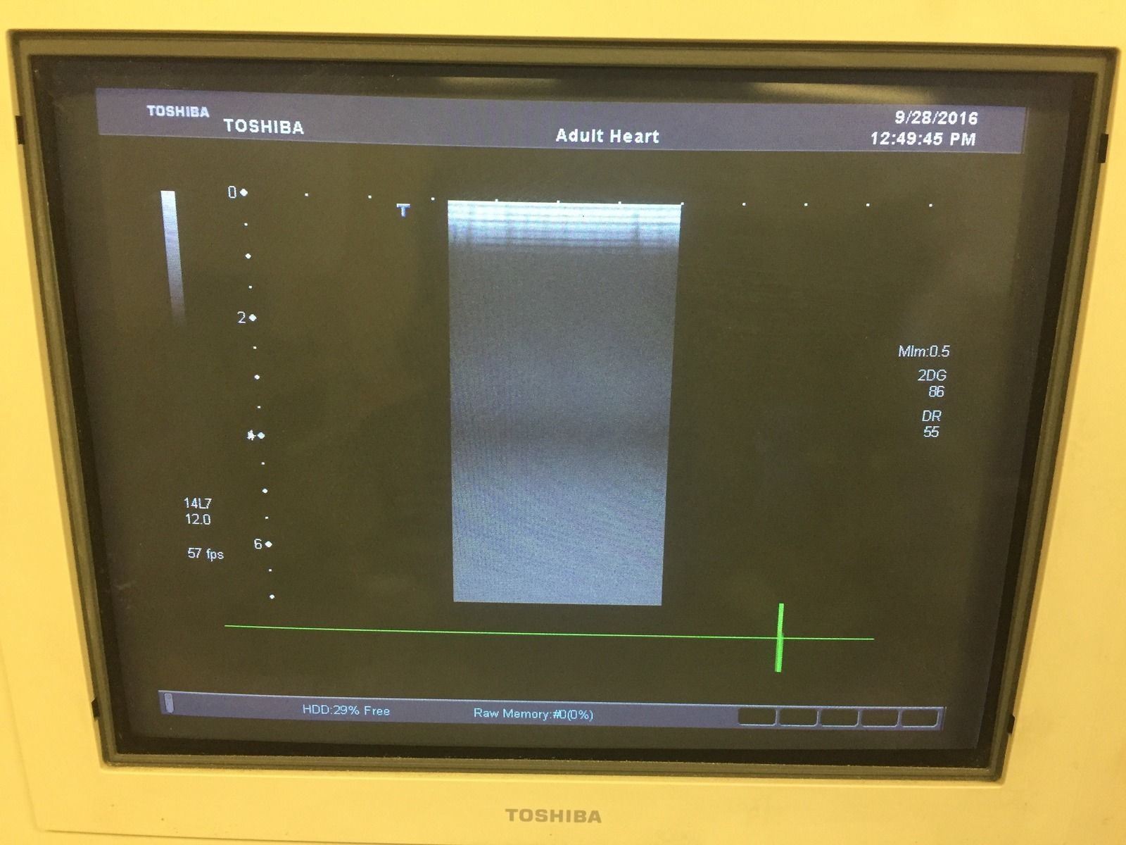 Toshiba Aplio PLT-1204AT 12MHz Linear Transducer Probe for Small Parts DIAGNOSTIC ULTRASOUND MACHINES FOR SALE