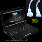 Digital Laptop Machine Ultrasound Scanner +Convex& Vignal &Linear 3 Probe &3D