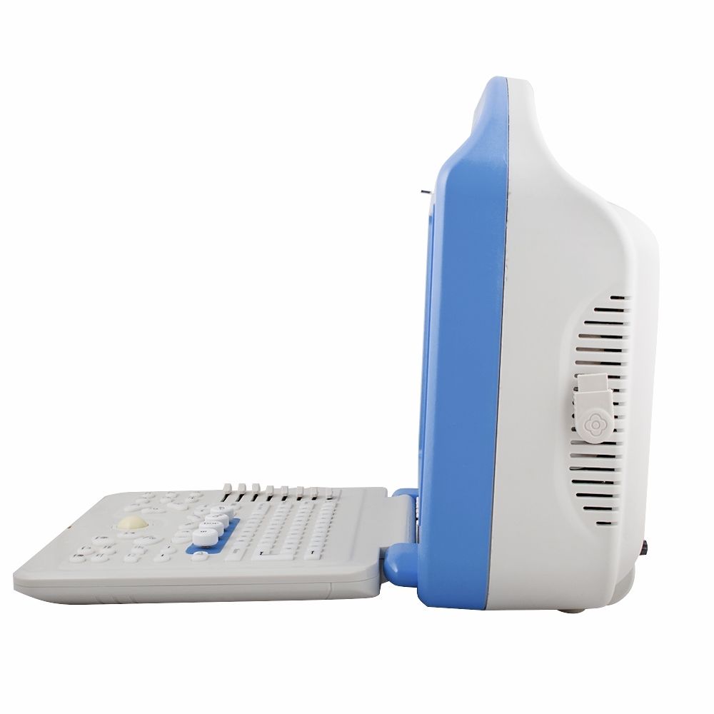 Portable B ultrasonic Color Doppler Ultrasound Scanner Convex +Linear 2 Probe A+ 190891271396 DIAGNOSTIC ULTRASOUND MACHINES FOR SALE