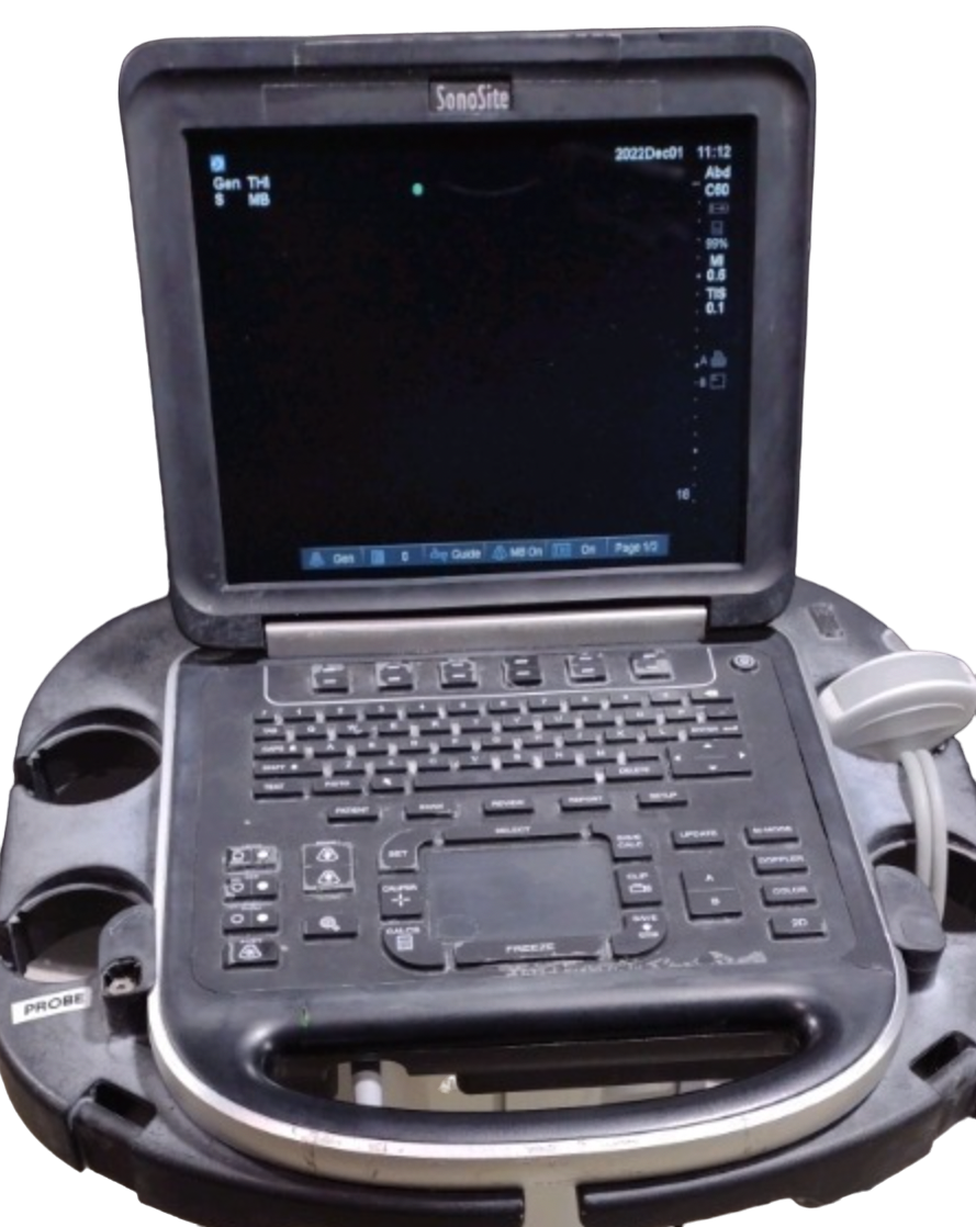 Sonosite Edge Portable Ultrasound 2013 & Convex probe C60x DIAGNOSTIC ULTRASOUND MACHINES FOR SALE